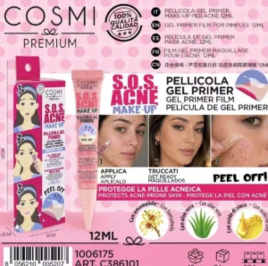 sos acne